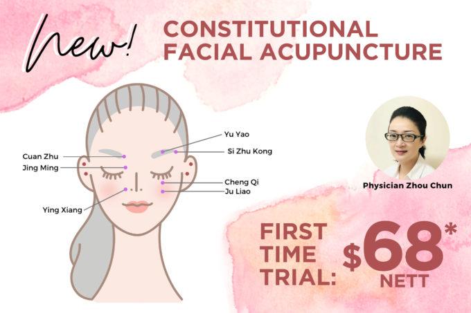 Post image of NEW! Constitutional Facial Acupuncture at $68 nett