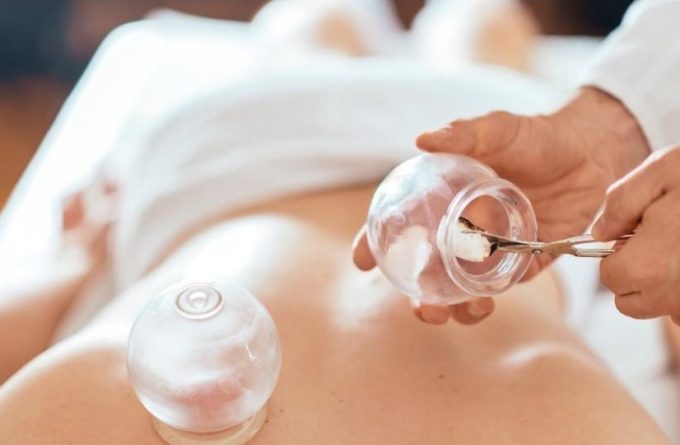 Benefits of TCM Cupping