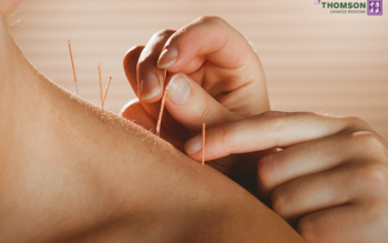 Blog image for The Role Of Acupuncture In Alleviating Chronic Pain