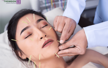 Blog image for Facial Acupuncture: What to Know & the Benefits