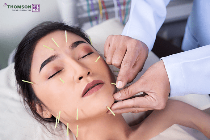 Facial Acupuncture: What to Know & the Benefits
