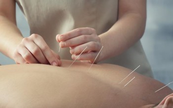 Blog image for ​​Acupuncture vs Dry Needling: What Are the Differences?