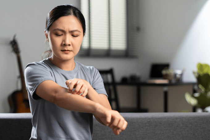 TCM-Role-in-Relieving-Eczema-Symptoms