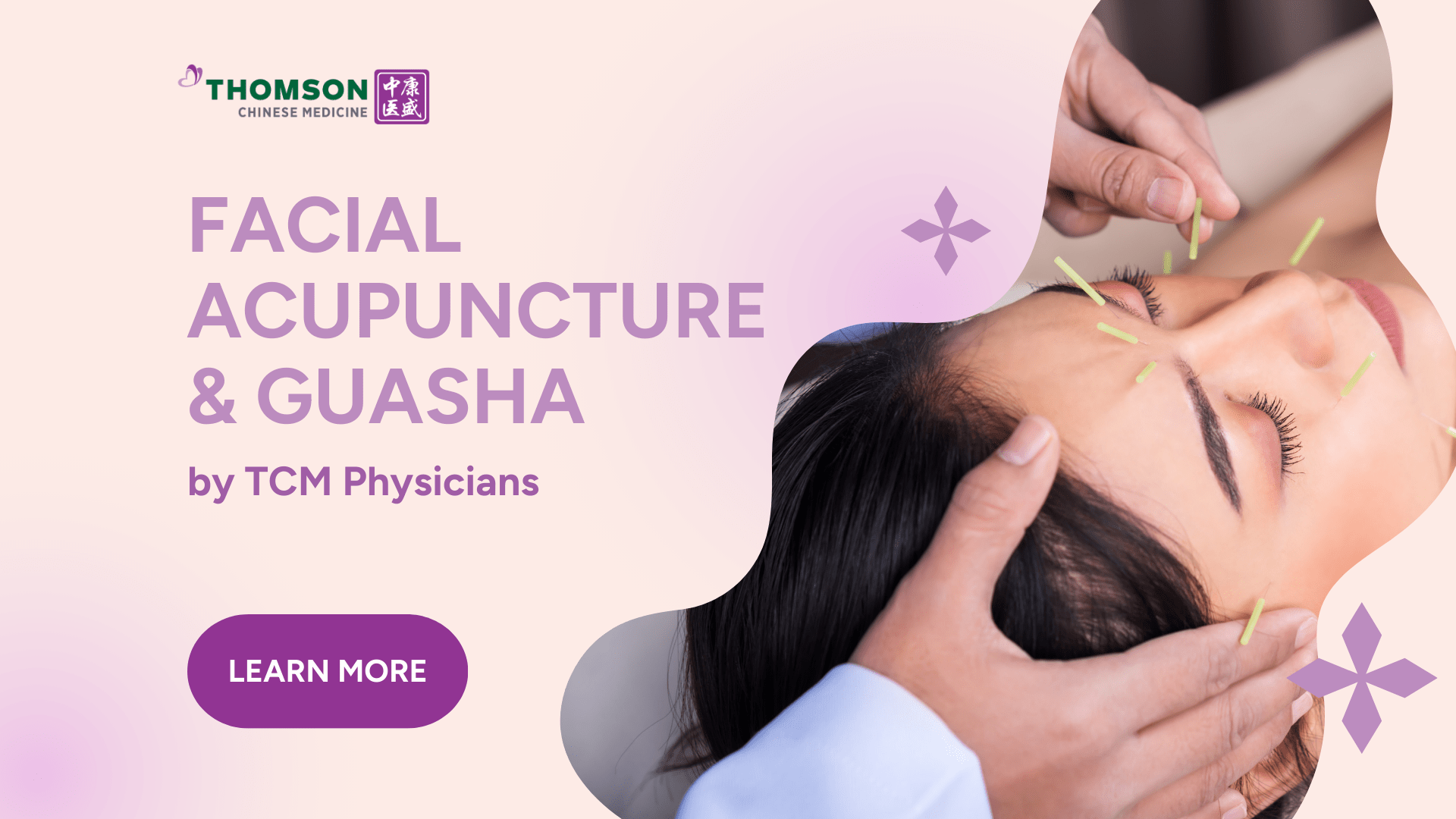 Post image of Facial Acupuncture & Guasha